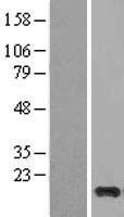 Cystatin S (CST4) Human Over-expression Lysates NM_001899