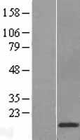 Cystatin D (CST5) Human Over-expression Lysates NM_001900