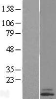 CST6 Human Over-expression Lysates NM_001323