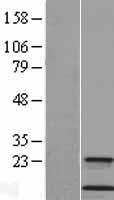 Cystatin A (CSTA) Human Over-expression Lysates NM_005213