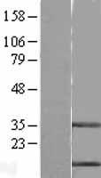 ls001476 stefin b cstb human over expression lysates nm 000100 wb testing 1