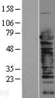 Cleavage stimulation factor 2 (CSTF2) Human Over-expression Lysates NM_001325