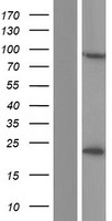 CSTF3 Human Over-expression Lysates NM_001326