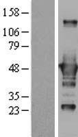 CTBP1 Human Over-expression Lysates NM_001012614