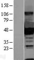 CTBP1 Human Over-expression Lysates NM_001328