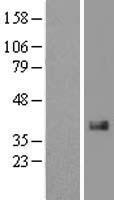 CCN2 Human Over-expression Lysates NM_001901