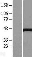 Cystathionase (CTH) Human Over-expression Lysates NM_001902