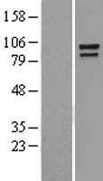 alpha 1 Catenin (CTNNA1) Human Over-expression Lysates NM_001903