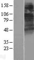 CTNS Human Over-expression Lysates NM_001031681