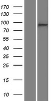 CTNND1 Human Over-expression Lysates NM_001085467
