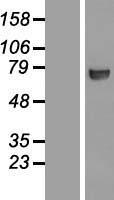 CTP synthase (CTPS1) Human Over-expression Lysates NM_001905