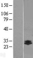 Chymotrypsin like protease (CTRL) Human Over-expression Lysates NM_001907