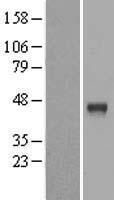 Cathepsin B (CTSB) Human Over-expression Lysates NM_001908