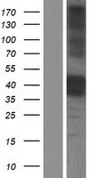 Cathepsin B (CTSB) Human Over-expression Lysates NM_147780