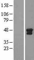Cathepsin D (CTSD) Human Over-expression Lysates NM_001909