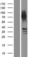 Cathepsin E (CTSE) Human Over-expression Lysates NM_148964