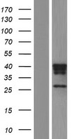 Cathepsin H (CTSH) Human Over-expression Lysates NM_004390