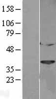 Cathepsin L (CTSL) Human Over-expression Lysates NM_001912