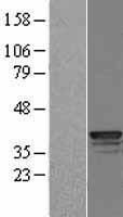 Cathepsin L (CTSL) Human Over-expression Lysates NM_145918