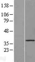 Cathepsin O (CTSO) Human Over-expression Lysates NM_001334