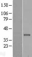 Cathepsin S (CTSS) Human Over-expression Lysates NM_004079