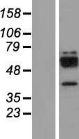 Cathepsin W (CTSW) Human Over-expression Lysates NM_001335