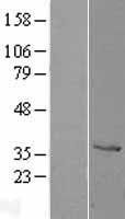 Cathepsin Z (CTSZ) Human Over-expression Lysates NM_001336