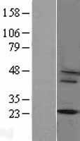CYBA Human Over-expression Lysates NM_000101