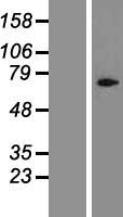 Cylicin 1 (CYLC1) Human Over-expression Lysates NM_021118