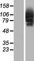 CYLD Human Over-expression Lysates NM_001042355