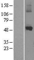 CYP1A1 Human Over-expression Lysates NM_000499