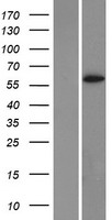 Cytochrome P450 1A2 (CYP1A2) Human Over-expression Lysates NM_000761