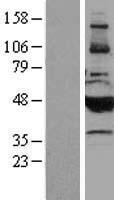 Cytochrome P450 2B6 (CYP2B6) Human Over-expression Lysates NM_000767