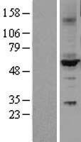 Cytochrome P450 2C9 (CYP2C9) Human Over-expression Lysates NM_000771