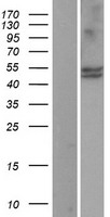 CYP11B1 Human Over-expression Lysates NM_000497