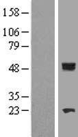 CYP11B1 Human Over-expression Lysates NM_001026213