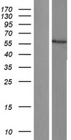 ls001586 cytochrome p450 17a1 cyp17a1 human over expression lysates nm 000102 wb testing 1