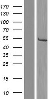 CYP21A2 Human Over-expression Lysates NM_001128590