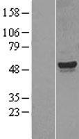 CYP26A1 Human Over-expression Lysates NM_000783