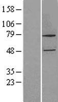 CYP27B1 Human Over-expression Lysates NM_000785
