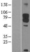 DAB1 Human Over-expression Lysates NM_021080