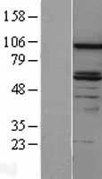 ls001601 dab2 human over expression lysates nm 001343 wb testing 1