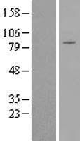 DGKB Human Over-expression Lysates NM_145695
