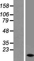 DAP1 (DAP) Human Over-expression Lysates NM_004394
