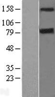 DAP Kinase 1 (DAPK1) Human Over-expression Lysates NM_004938