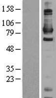 ls001616 daxx human over expression lysates nm 001141969 wb testing 1