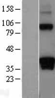 ls001618 dazl human over expression lysates nm 001351 wb testing 2