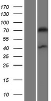 Drebrin (DBN1) Human Over-expression Lysates NM_004395
