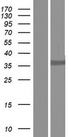 D Box Binding Protein (DBP) Human Over-expression Lysates NM_001352