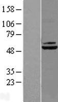 DBT Human Over-expression Lysates NM_001918